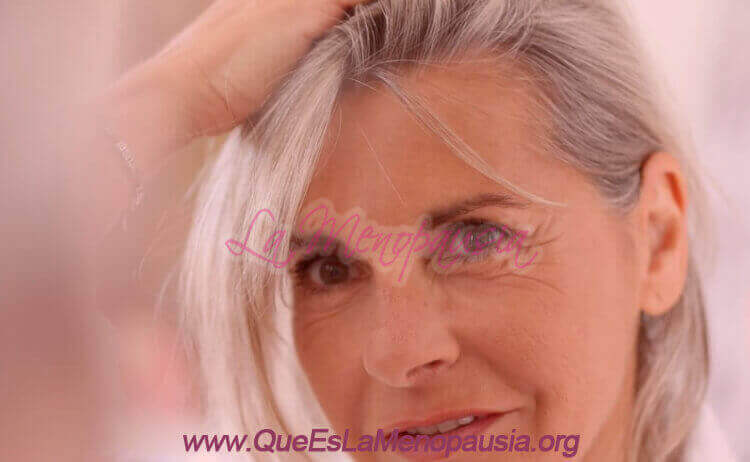 Mujer con alopecia en la menopausia - Injerto Capilar