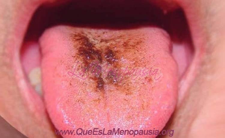 Causas