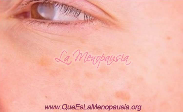 Son peligrosas las manchas amarillas en la piel