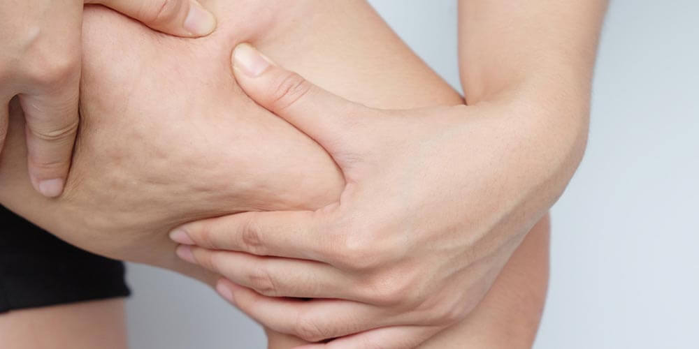 ¿Cómo la lipasa puede reducir la celulitis y la adiposidad de forma efectiva? 2 Entendiendo la lipasa y su función en el cuerpo