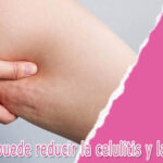 ¿Cómo la lipasa puede reducir la celulitis y la adiposidad de forma efectiva?