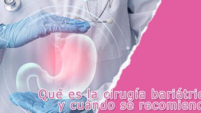 Qué es la cirugía bariátrica y cuándo se recomienda