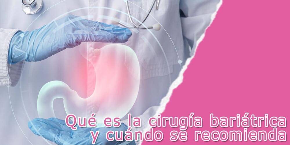 Qué es la cirugía bariátrica y cuándo se recomienda 1 Qué es la cirugía bariátrica y cuándo se recomienda