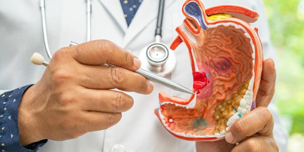 Qué es la cirugía bariátrica y cuándo se recomienda 2 Qué es la cirugía bariátrica