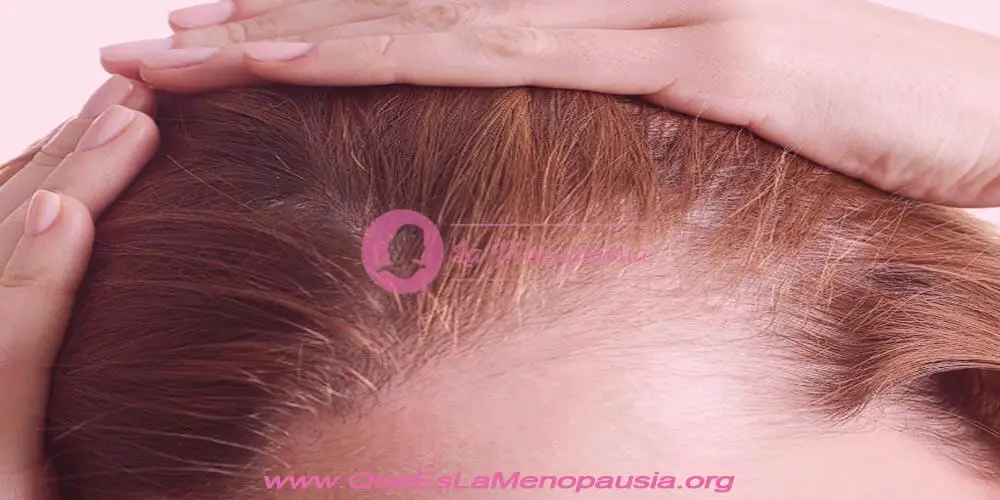Señales de alerta de alopecia femenina